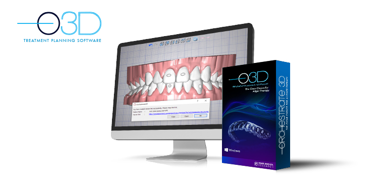 O3D Treatment Planning Software